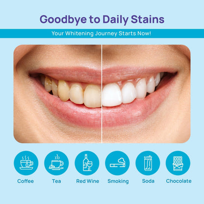 WhiteBite Pro Teeth Whitening Pens for Sensitive Teeth (4 Pens) – 35% Carbamide Peroxide Gel, Desensitizing Gel – Fast Whitening, Enamel-Safe, Travel-Friendly