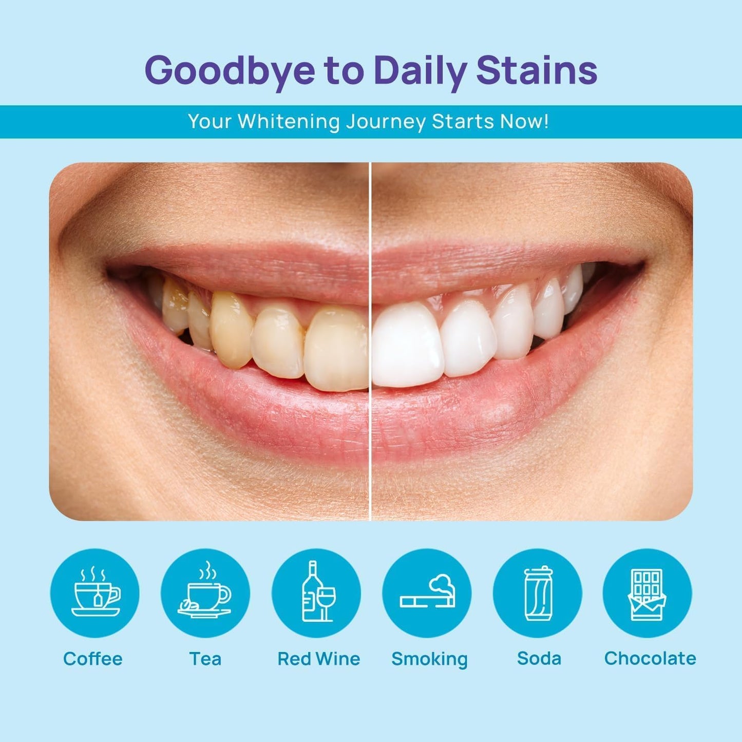 WhiteBite Pro Teeth Whitening Pens for Sensitive Teeth (4 Pens) – 35% Carbamide Peroxide Gel, Desensitizing Gel – Fast Whitening, Enamel-Safe, Travel-Friendly